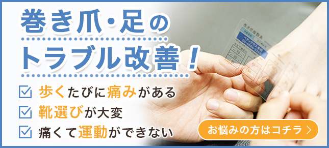 巻き爪・足のトラブル改善